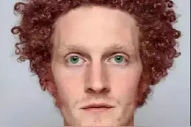 此类人即将灭绝，精子库都不接受他们的基因！看头发就能一眼认出图片
