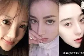 眼睛割了双眼皮还是没有明星大？以下3种中招的朋友赶紧修复吧图片