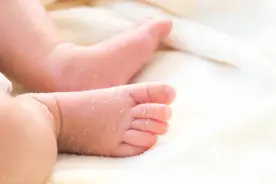 育儿心得：新手妈妈知道的事，新生儿期宝宝脱皮怎么回事呢？图片