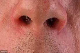 为何有些人鼻毛经常窜出来？原因不难理解，男性朋友很受益！图片