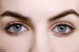 双眼皮手术 什么人才适合做？图片