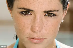 不想长黄褐斑？不如试试这个方法，到老了脸也会很干净图片