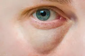 肾虚？不抽血不化验，注意以下几点，及时发现肾脏问题图片