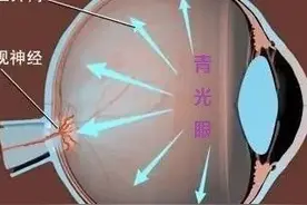 健康科普堂 | 青光眼到底是怎么回事？这四类人群需警惕！图片