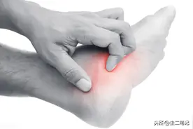 柴胡的妙用——小腿反复瘙痒3年，中医辨证用药1剂显效图片