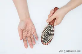 世界唯一公认有效的「生发药」，很多人却不知道图片