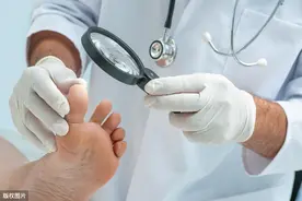 脚痛暗示疾病上身？这些脚部症状都在提醒你：身体出问题了图片