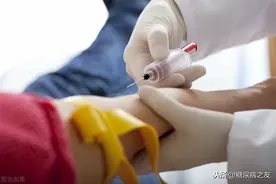 推荐糖尿病患者监测C-肽的4个理由，我患糖尿病46年，每年都测C-肽图片