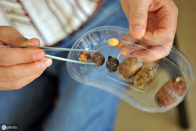 犬猫草酸钙结石原因及管理