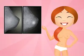 乳腺良性肿瘤有哪些，能治好吗？图片