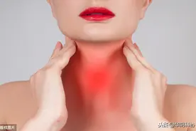 眼睛太突出怎么办？你可能犯了这种病图片