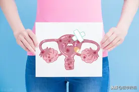 40%女性都可能患子宫肌瘤！出现这些症状，就需要去治疗了图片