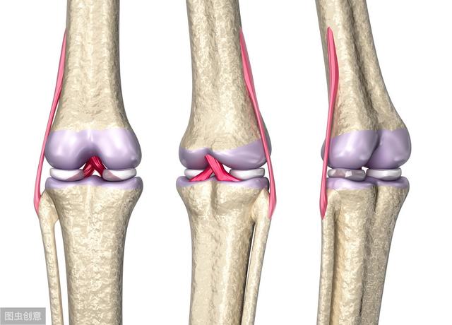 前叉重建术后,如何才能避免韧带松弛呢?