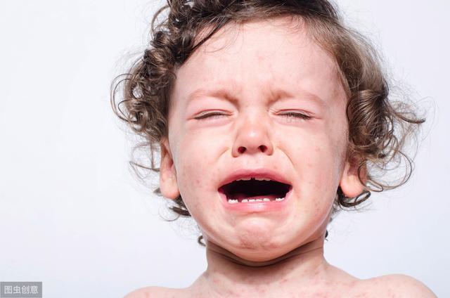 8岁女孩脸部有毛囊角化丘疹