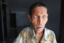 中国盲人超千万！随着年龄的增长，你会是其中一员吗？图片