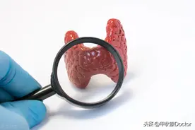 永久性甲减，需终生吃药，除了优甲乐别无选择图片