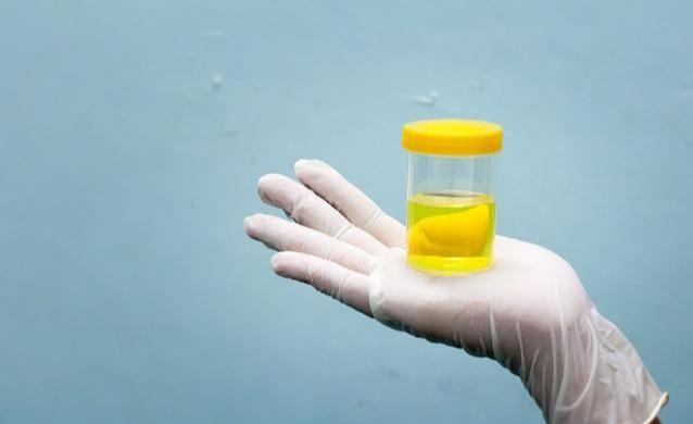 转氨酶是肝脏的“晴雨表”，转氨酶升高就是肝脏出问题了？