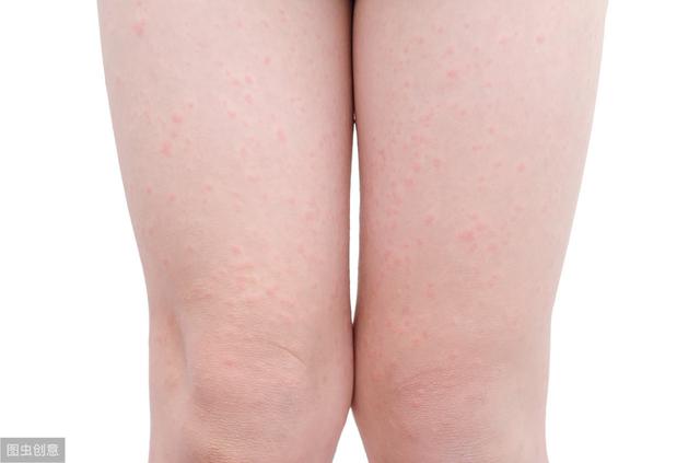 手臂上鸡皮肤解决方法