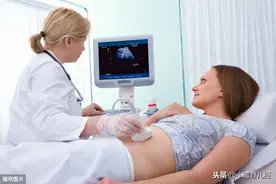做B超的一些好心医生，会有“暗语”来提醒孩子性别，孩妈懂吗？图片