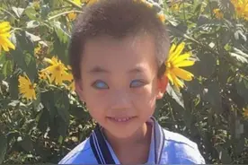 小男孩天生“鬼眼”，出生4个月被父亲抛弃，如今过得怎么样？图片
