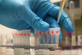 世界献血者日与你探讨人类医学未解之谜：为什么要有血型？图片