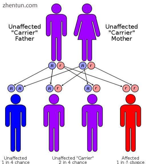 孩子尿中枫糖味，小心枫糖尿症，严重可致死！虽罕见但真实存在