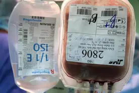 血荒时，围术期患者输血需求的自救与调控策略图片