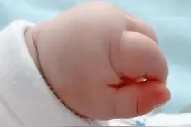 宝妈吐槽：母乳喂养的宝宝小手像猪蹄，放出图片后，网友不淡定了图片