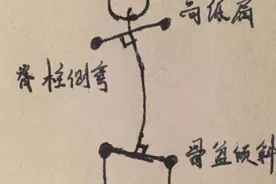 长短腿和高低肩，跟骨盆侧倾有什么关系？图片