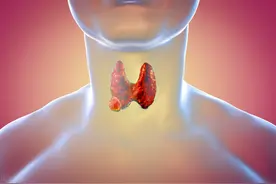 什么是甲状腺癌？早期隐匿，大部分手术预后好，5项管理要知道图片