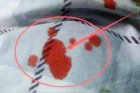 床单沾上血渍不用愁，教你简单方法，新旧血渍都能洗得干干净净图片