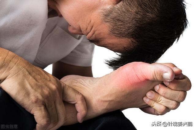 双氯芬酸钠治疗痛风吗（痛风发作如针扎）