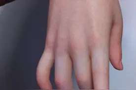 手办越逼真越好么？看看那款血管都清晰可见的手办，可能并非如此图片