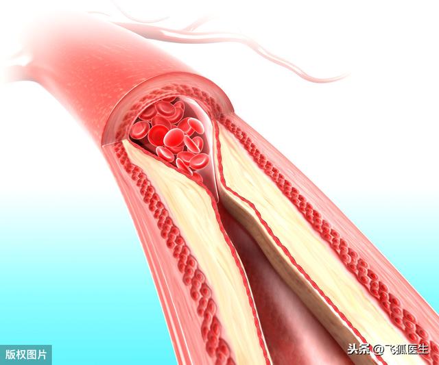 调整血脂药种类有哪些？使用指征是什么？用法用量注意事项有哪些