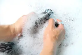 都成年了，还需要割包皮吗？图片