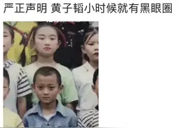 我不允许有人再分不清卧蚕和黑眼圈！图片