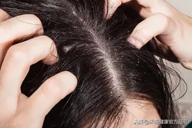 屁股痒、脚痒、私处痒？5 个部位出现这些变化，千万小心图片