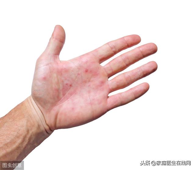鱼鳞病怎么去角质