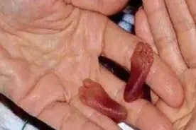 2006年，出生时不足1斤的拇指姑娘，奇迹般活下来之后怎么样了？图片