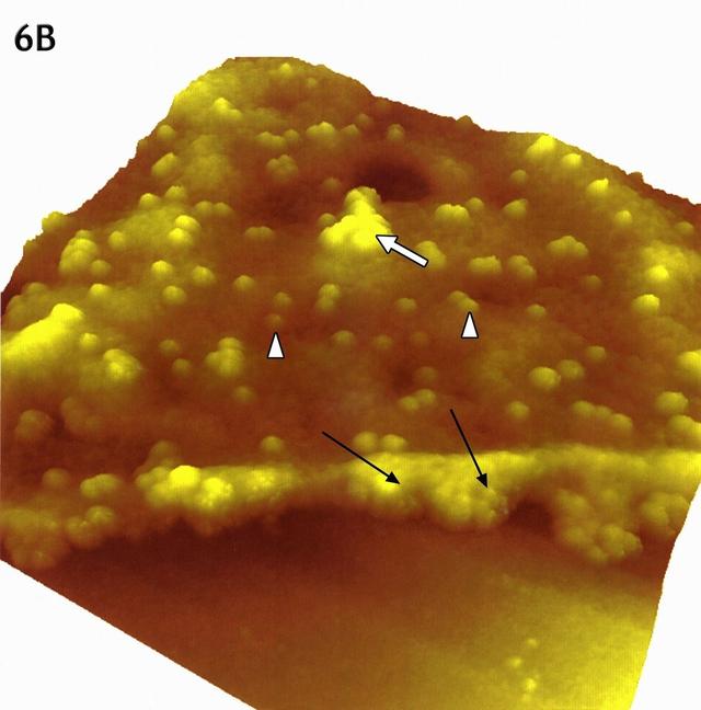 鍐犵姸鐥呮瘨鐨凷铔嬬櫧锛熷強鍏朵粬缁撴瀯铔嬬櫧鏄粈涔堬紵