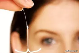 那些遗忘在体内的节育环该取出了图片