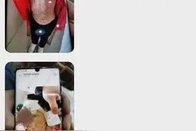被虐女童转至哈尔滨治疗，知情人：医院曾多次报警，凡凡父母称孩子“自残”图片
