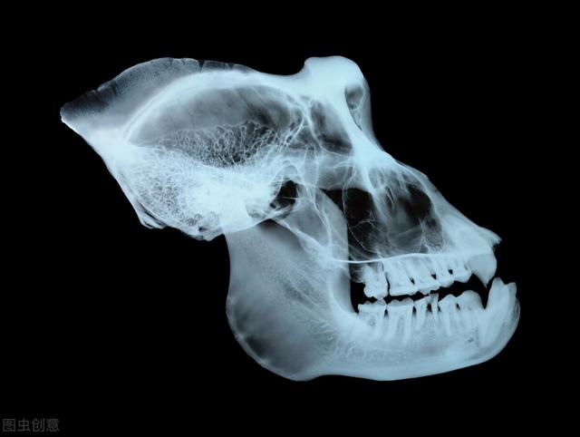 角化囊肿发展迅速