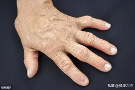 肺部有癌，手指先知！手指出现这个症状，警惕被肺癌缠上图片