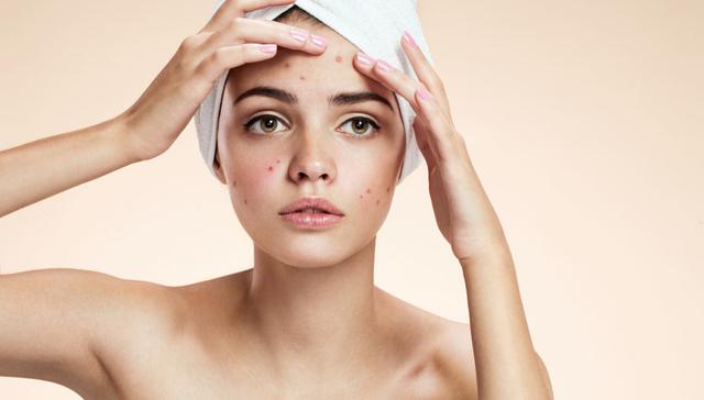 非角化型细胞额