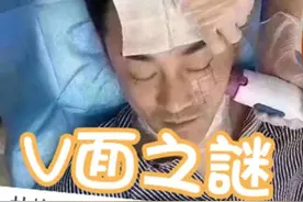 40岁林峰也做医美！拉皮画面被曝光，“冻龄男神”之谜疑被揭穿图片