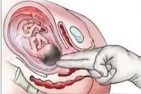 顺产有多疼？网友：分分钟要疼晕过去！分娩四阶段，一个赛一个疼图片