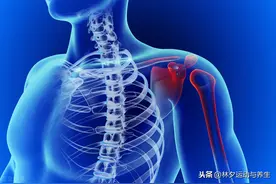 肩疼痛不敢抬胳膊，一定是肩周炎吗？看看这4种情况，你属于哪种图片