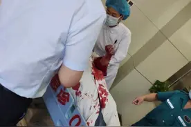 郑州伤医案探访：保安称为不增加患者紧张感，连防暴钢叉都不能拿，预防很难图片