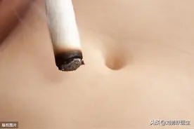 缩阳症，凶险无比，艾灸急救图片